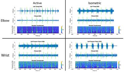 Aligned MG, filtered SEG, and wavelet transformed SEG data for active and isometric movements of wrist and elbow for various subjects.