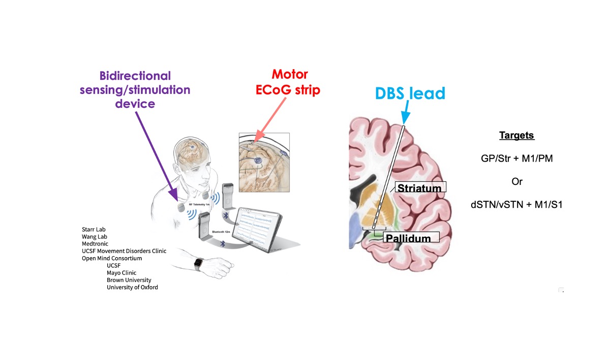 Figure with two illustrations that show the multisite chronic wireless brain implants used in these experiments